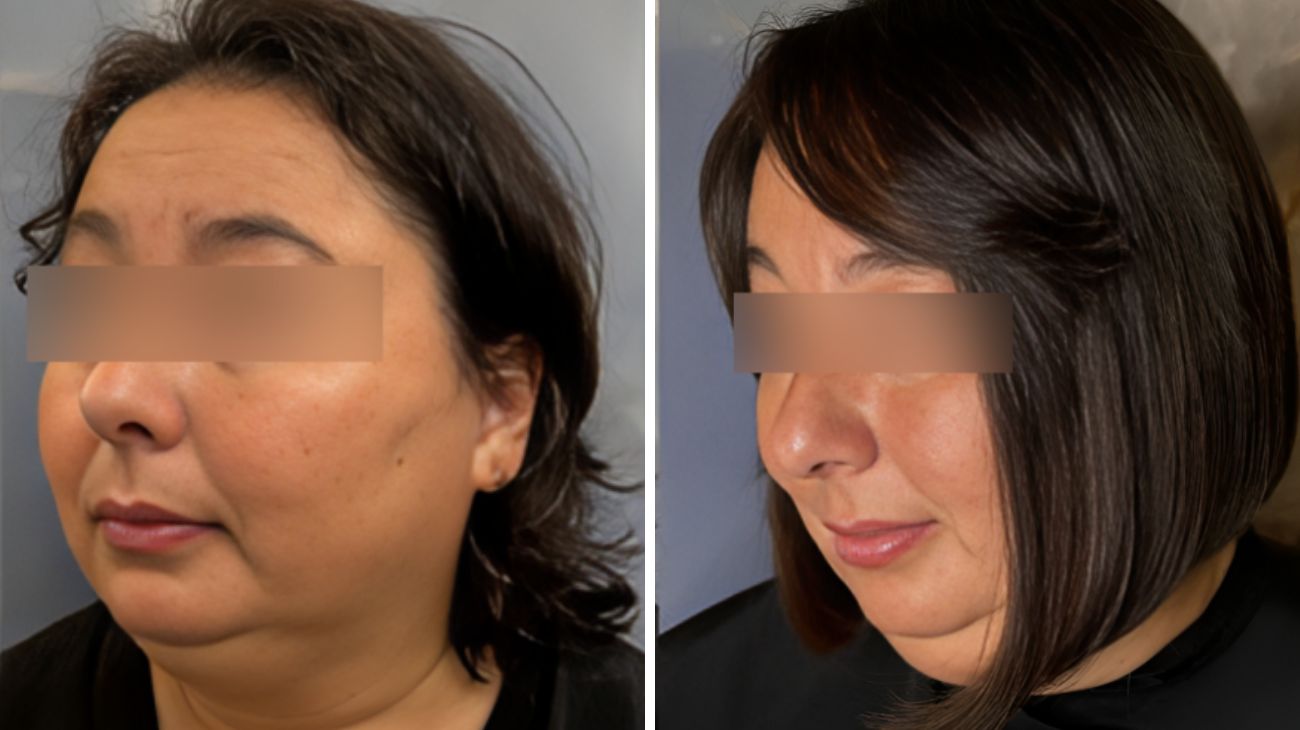 federico look cliente