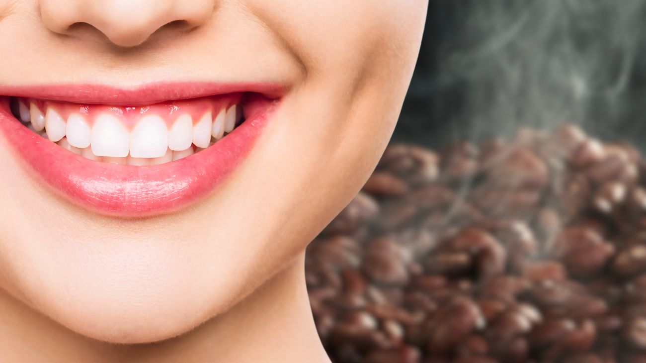 come eliminare macchie dai denti