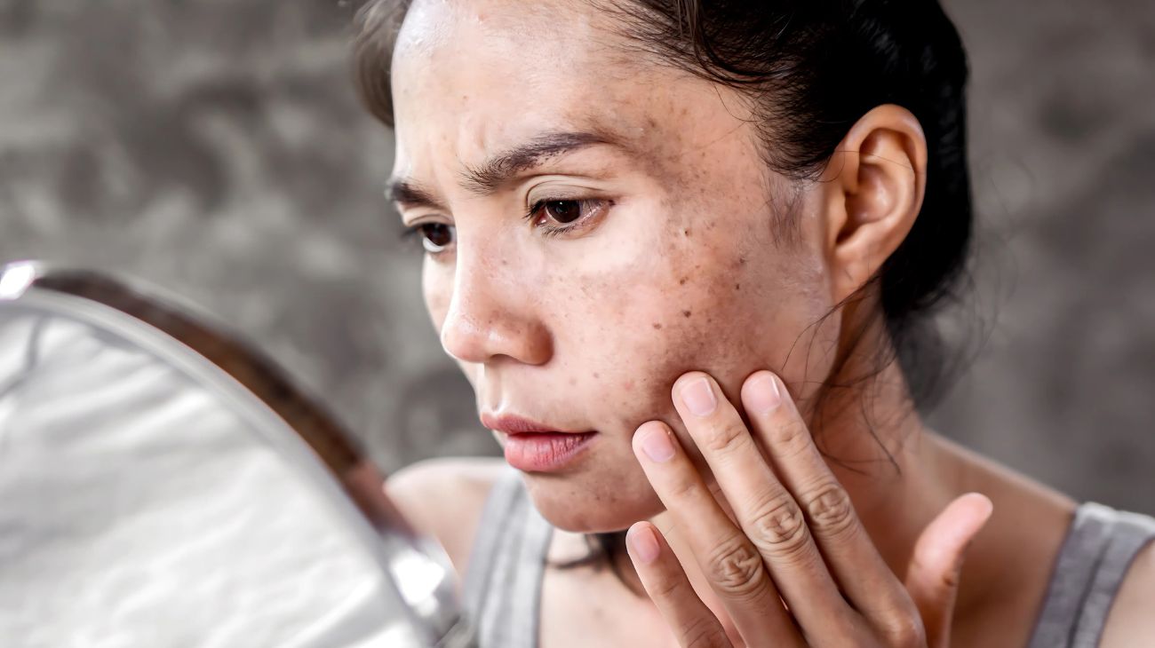 alimenti che danneggiano la pelle